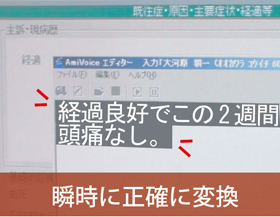 経過良好でこの２週間頭痛なし　瞬時に正確に変換！